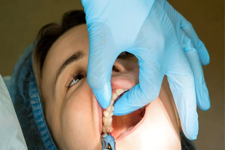 Wisdom Tooth Removal Guide for Safe Recovery and Care Wisdom Tooth Removal Guide for Safe Recovery and Care